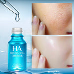 VENZEN Hyaluronic Acid Serum Face Moisturizer  Essence Whitening Lifting Visage Anti aging Cream Acne Skin serum Women Skin Care
