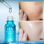 VENZEN Hyaluronic Acid Serum Face Moisturizer  Essence Whitening Lifting Visage Anti aging Cream Acne Skin serum Women Skin Care
